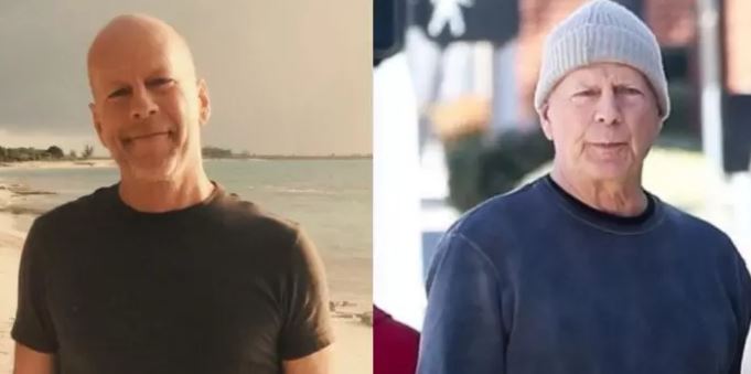 Publican primeras imágenes de Bruce Willis tras ser diagnosticado con demencia frontotemporal thumbnail