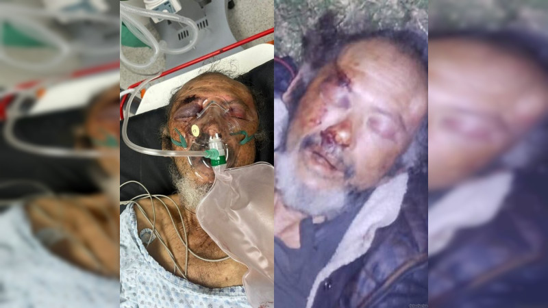 Persona de la tercera edad busca a sus familia, se encuentra gravemente hospitalizado en Uruapan thumbnail